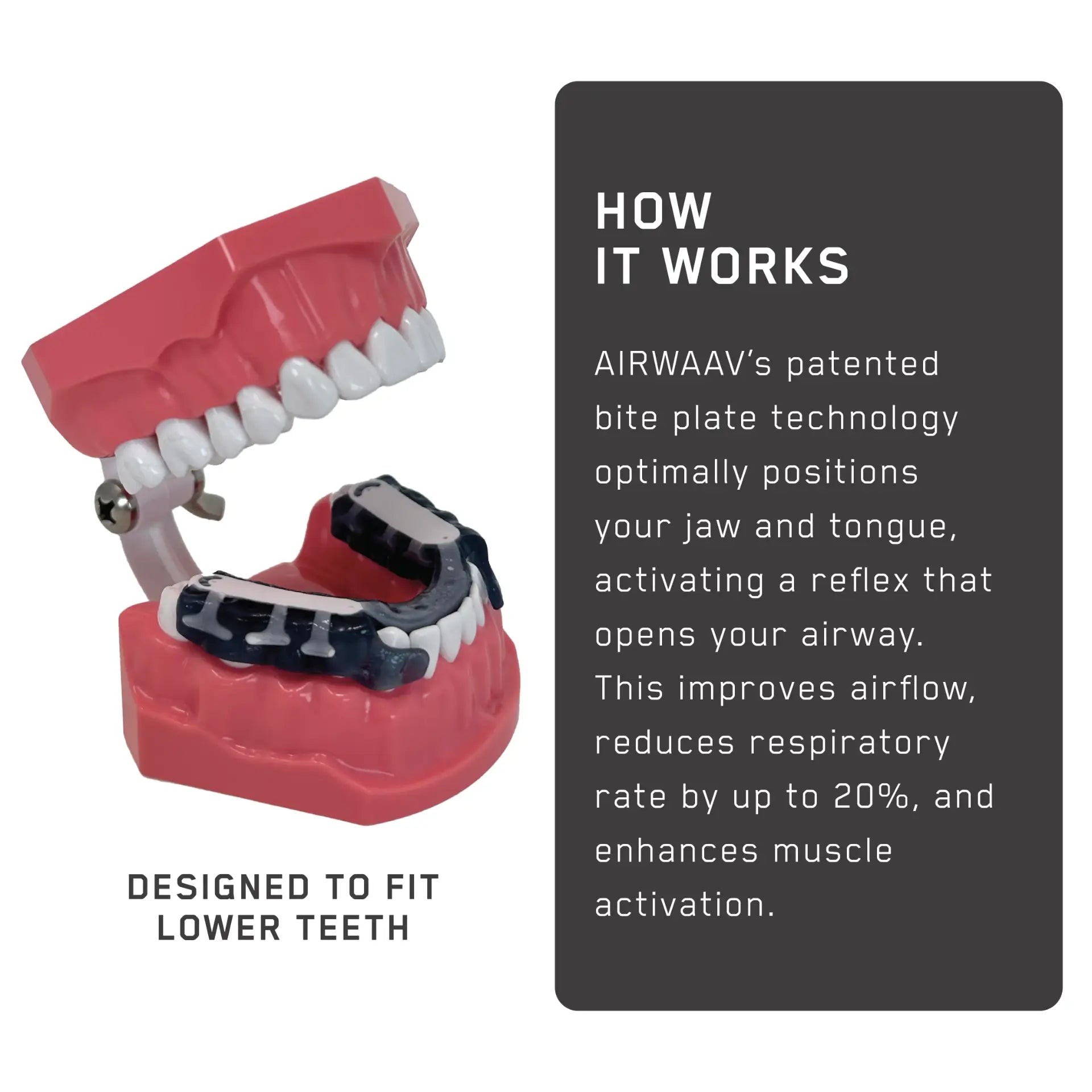 Red and black mouthpiece with bite plate designed to fit lower teeth, shown on dental model display.